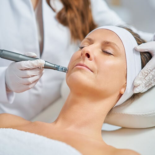 PRP / Ozone Microneedling